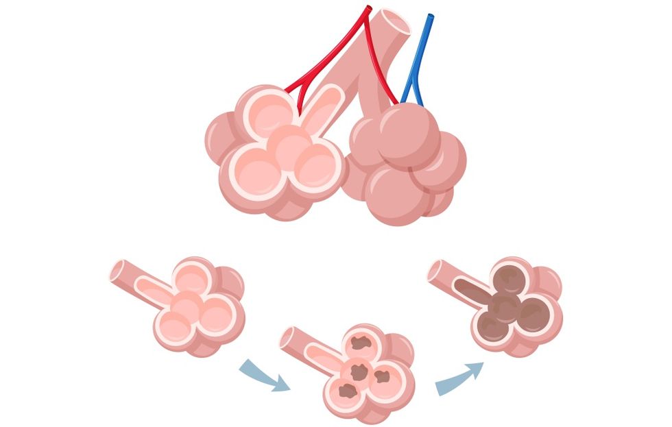 siffler respiration