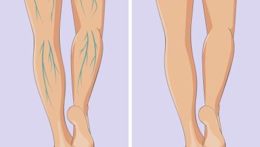 6 façons dont vos jambes peuvent indiquer un problème lié à vos organes internes