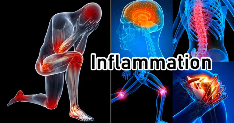 Un régime contenant des aliments anti-inflammatoires