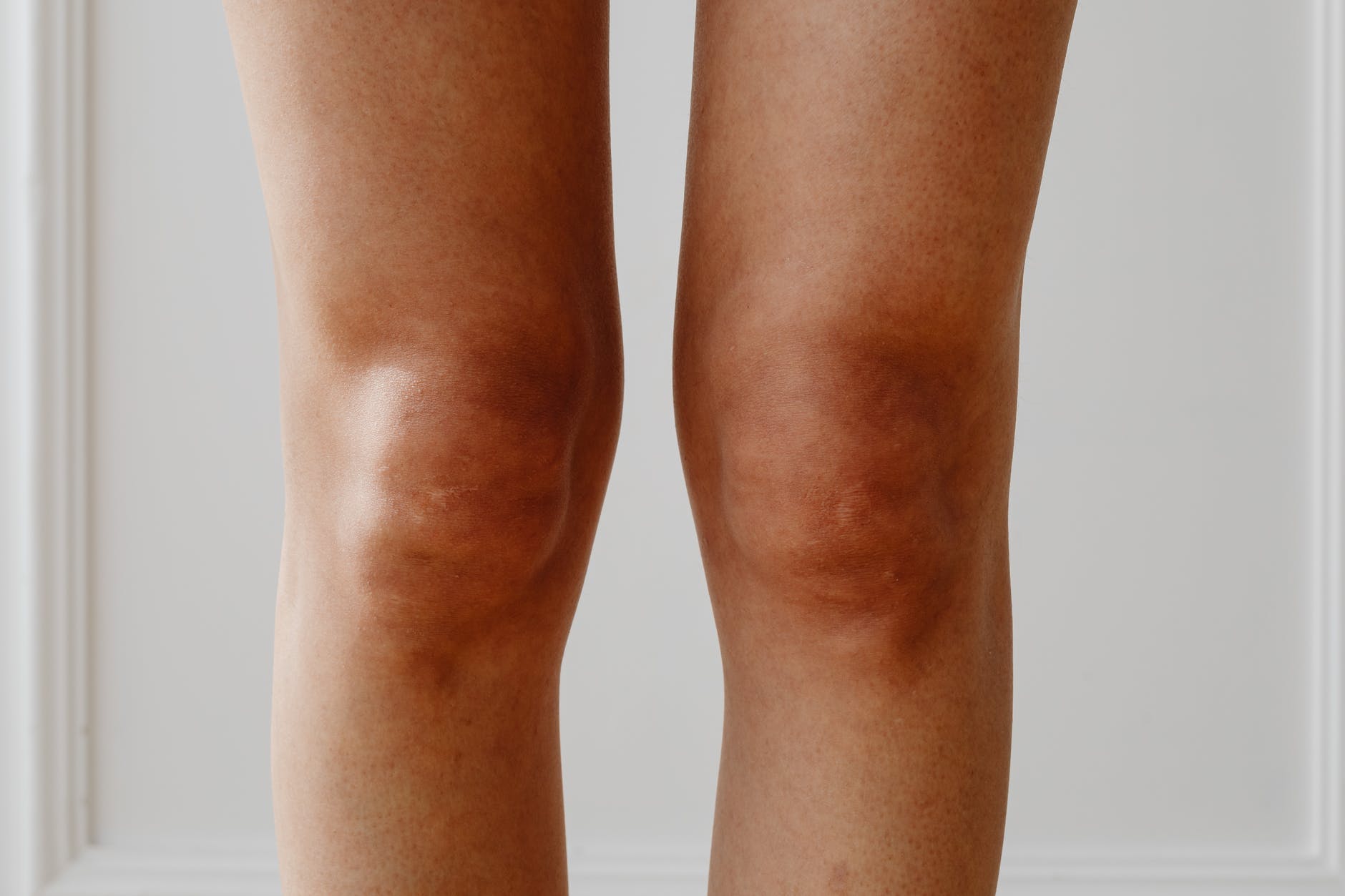 Les causes à l’origine de la douleur aux genoux