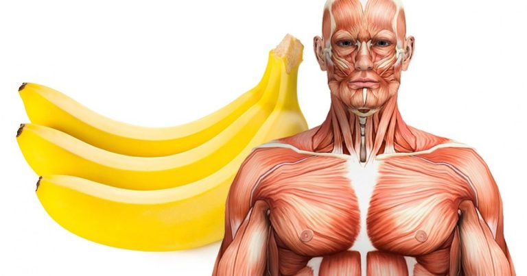 bananes Réduire le risque d'anémie