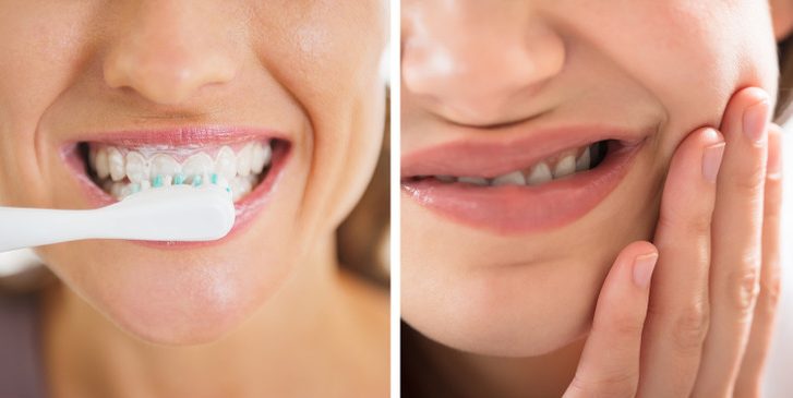 Cela peut rendre vos dents plus sensibles