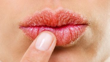 7 méthodes naturelles pour avoir des lèvres pulpeuses