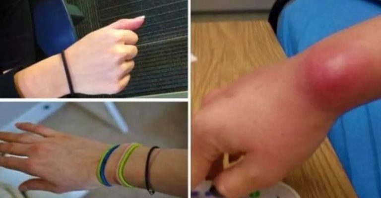 vous ne devriez pas mettre votre élastique à cheveux autour du poignet