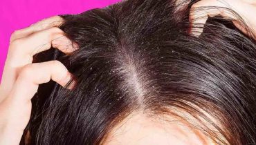 5 remèdes maison pour éliminer l’excès de sébum de vos cheveux sans devoir les laver aussi souvent