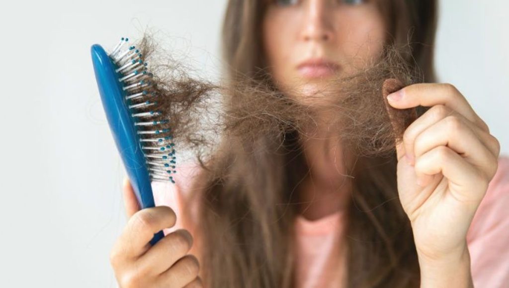 7 façons de savoir si vous souffrez d’une perte de cheveux00 perte de cheveux excessive