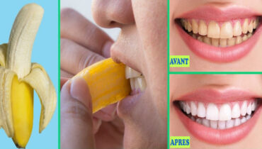 Comment blanchir ses dents avec une peau de banane ? 3 étapes à suivre