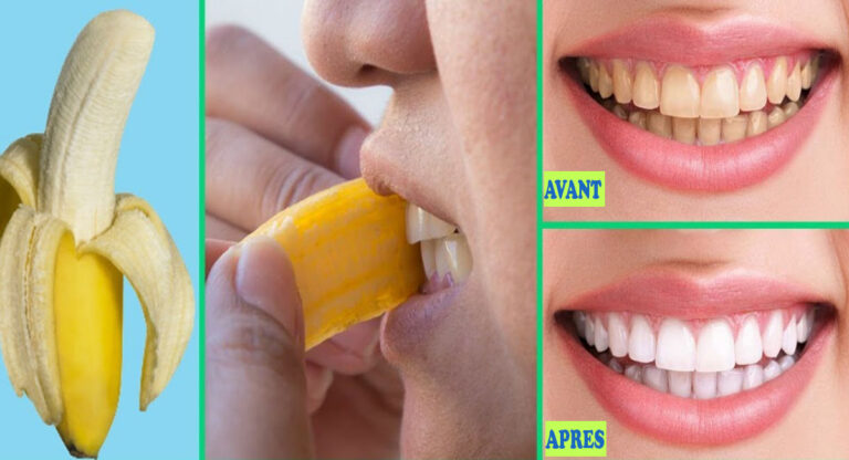Comment blanchir ses dents avec une peau de banane