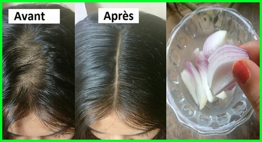 la pousse des cheveux la pousse des cheveux