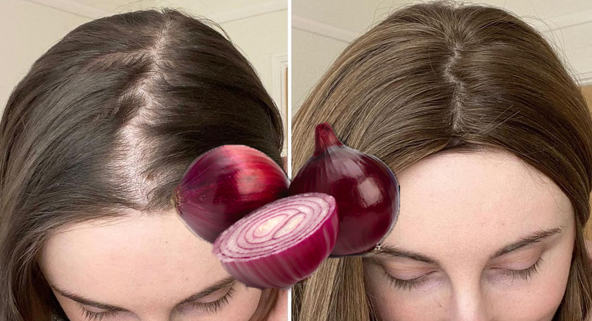 Voici pourquoi et comment vous devriez utiliser le jus d’oignon pour faire repousser vos cheveux