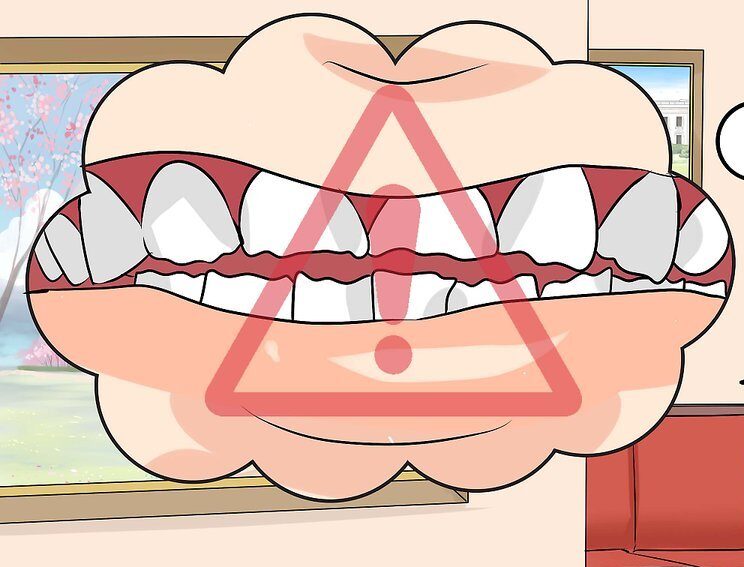 Dents abîmées