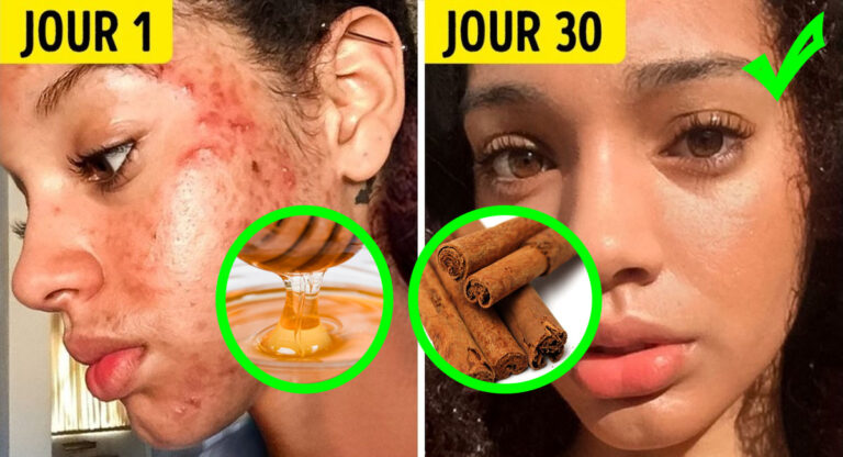 problemes de peau et masques naturels