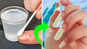 9 remèdes pour renforcer ses ongles naturellement 10 9 remèdes pour renforcer ses ongles naturellement Le vinaigre de cidre de pomme 1 9 remèdes pour renforcer ses ongles naturellement graines de fenugrec