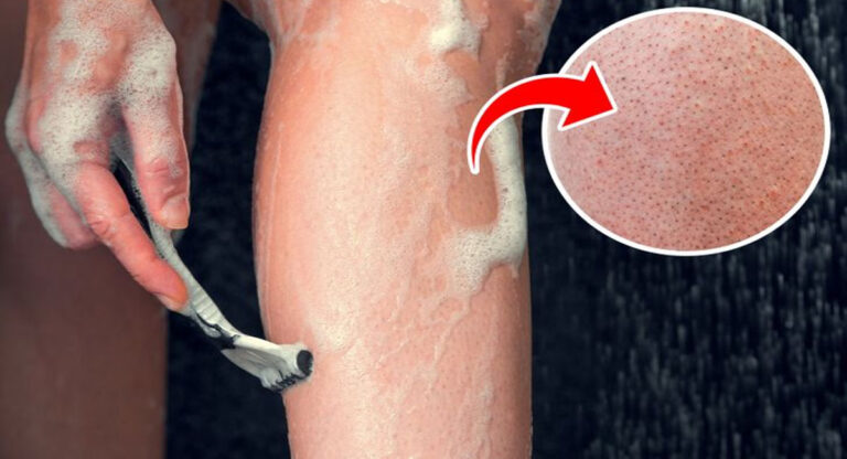 L’effet « jambes de fraise »
