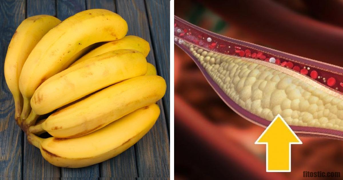 Les bananes peuvent prévenir les calculs rénaux.