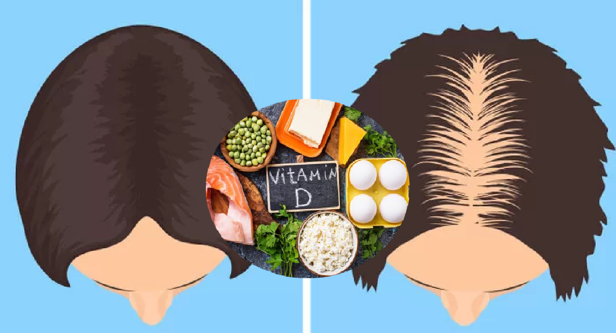 vitamine D 6 indices surprenants de carence en vitamine D lésion nerveuse
