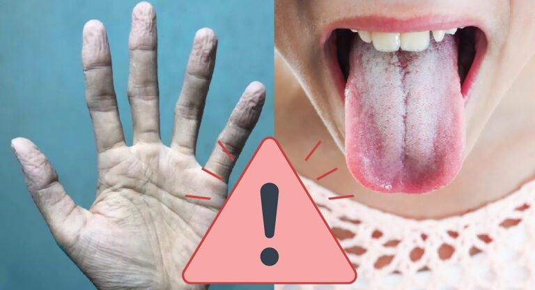 10 symptômes indiquant que votre corps est malade