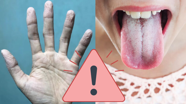 10 symptômes indiquant que votre corps est malade aléatoires alimentaire aliments allergique associées atteintes B2 B3 B6 et B7 ballonnements blanches Blé bleus boire buccale bucco cardiaques carence cheveux chevilles chute circulation coagulation consommation constante contractions contrôler corps cutanées d'eau d'ecchymoses d'eczéma d'uriner dentaire déshydratation diabète doigts ecchymoses endroits éruptions estomac exposition fatigue fer fièvre généralement gluten gonflement grossesse hydraté hygiène immunitaire inadéquate inexpliquées informer irrégulières l'eau langue lésions mains maladie mauvaise medicaments muguet musculaires oculaire oculaires parties pellicules phénomène prédiabète problème problèmes rénale repas rides Rouge s'accompagne sécheresse sel signe Sjögren soif symptôme symptômes système taches thyroïde thyroïdiennes vieillissement vitamines zinc