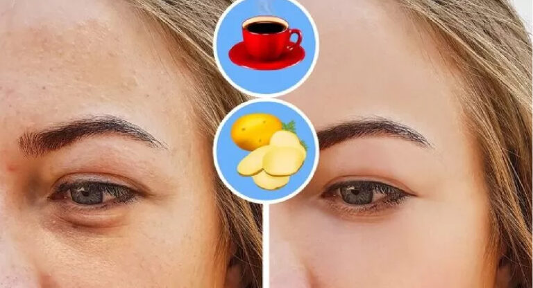 Les bienfaits du café pour la peau et les cheveux